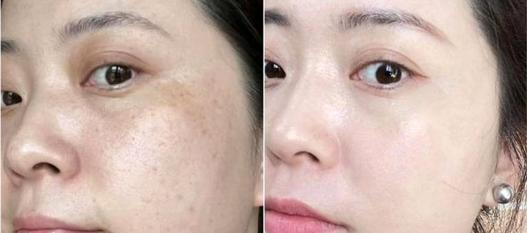6 Good habits for your skin before bed that will help you look as young as 20.