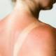 How to soothe sunburned skin with spinach: a natural and easy-to-apply home remedy.