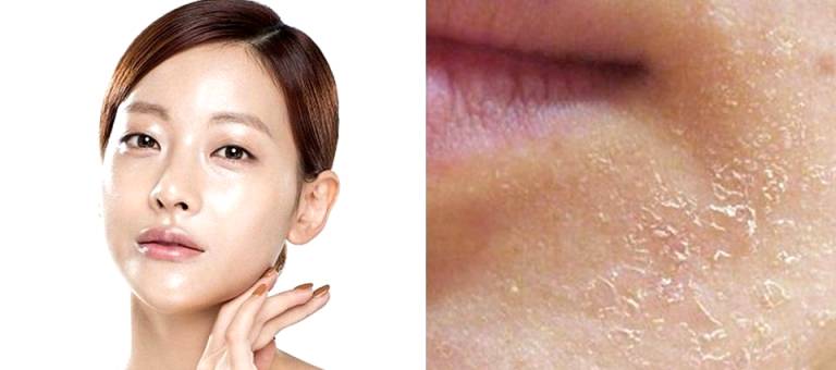 6 signs that make your face look older than your age and how to effectively improve it.