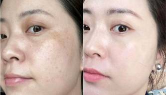 6 Good habits for your skin before bed that will help you look as young as 20.