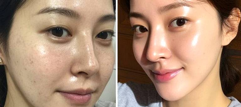 Do these 4 things before bed, and your skin will be 'rejuvenated,' smooth and beautiful like it was when you were 18, with noticeably smaller pores.