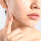 Effectively reduce hidden acne: build a proper skincare routine starting from the basics.