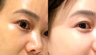 Effective ways to moisturize your skin in the summer to keep it plump and healthy.