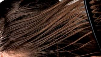 3 seemingly harmless habits that make hair greasy quickly and scalp prone to oiliness.
