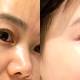 Effective ways to moisturize your skin in the summer to keep it plump and healthy.