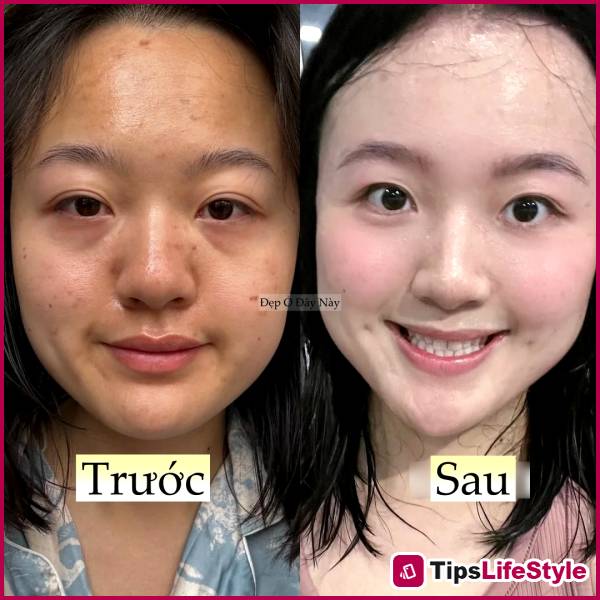 images 2 of Doing these 5 things before bed completely transformed my skin.