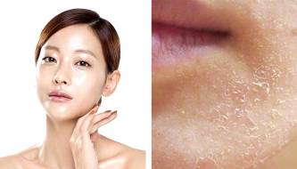 6 signs that make your face look older than your age and how to effectively improve it.