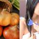 Does onion juice really help hair growth? How to use it correctly to avoid scalp irritation.