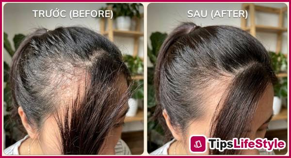 images 1 of After age 40, experts reveal a simple hair washing method that can noticeably thicken hair in just a few months.