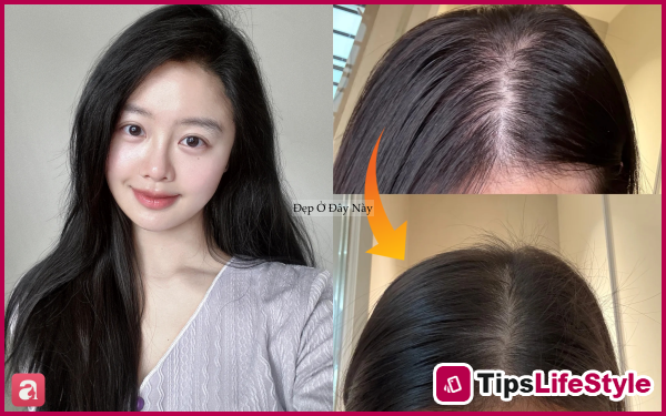 images 1 of My hair was falling out so much that patches of scalp were visible, so I decided to follow these 5 hair care rules to get my thick, black hair back.