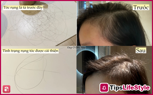 images 3 of My hair was falling out so much that patches of scalp were visible, so I decided to follow these 5 hair care rules to get my thick, black hair back.