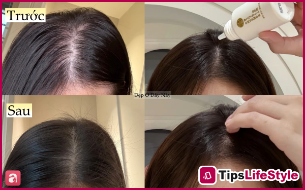 images 5 of My hair was falling out so much that patches of scalp were visible, so I decided to follow these 5 hair care rules to get my thick, black hair back.