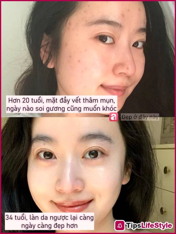 images 1 of Having beautiful skin at 34 doesn't depend on expensive cosmetics, but on these 3 habits.