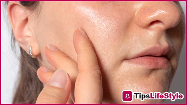 images 1 of Oily skin in summer: 3 principles to help control shine and reduce breakouts.