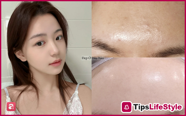 images 2 of Few people know this: Acid toners can help reduce acne, eliminate odor, and brighten skin from head to toe.