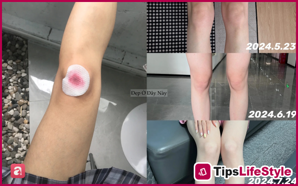 images 5 of Few people know this: Acid toners can help reduce acne, eliminate odor, and brighten skin from head to toe.