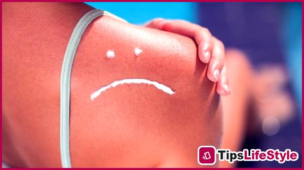 images 1 of Proper treatment of sunburned skin is essential for faster recovery and minimizing damage.