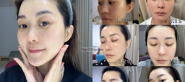 I went to bed early and applied this to my skin every night, and after a month, my skin completely transformed.