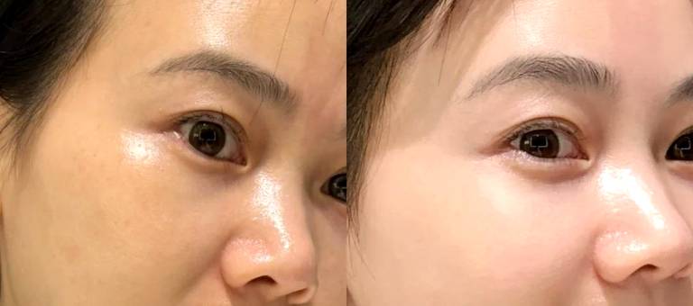 Effective ways to moisturize your skin in the summer to keep it plump and healthy.
