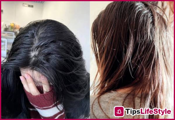 images 2 of 3 seemingly harmless habits that make hair greasy quickly and scalp prone to oiliness.