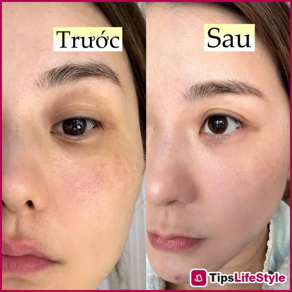 images 6 of I went to bed early and applied this to my skin every night, and after a month, my skin completely transformed.