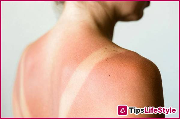images 1 of How to soothe sunburned skin with spinach: a natural and easy-to-apply home remedy.