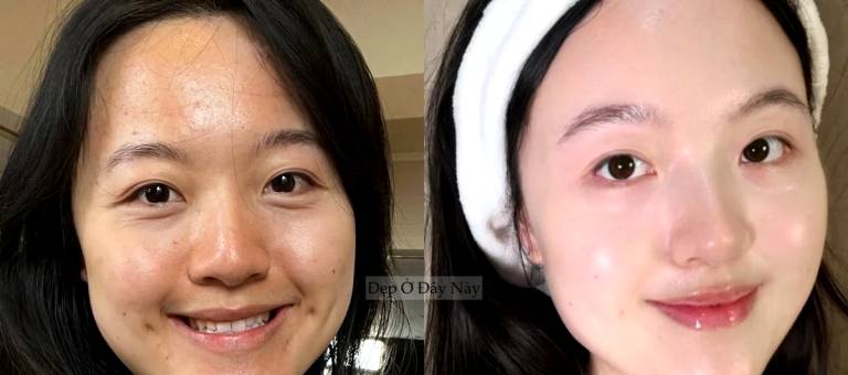 Doing these 5 things before bed completely transformed my skin.