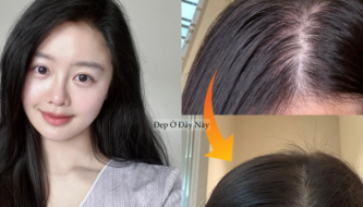 My hair was falling out so much that patches of scalp were visible, so I decided to follow these 5 hair care rules to get my thick, black hair back.