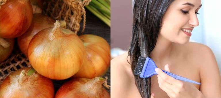 Does onion juice really help hair growth? How to use it correctly to avoid scalp irritation.