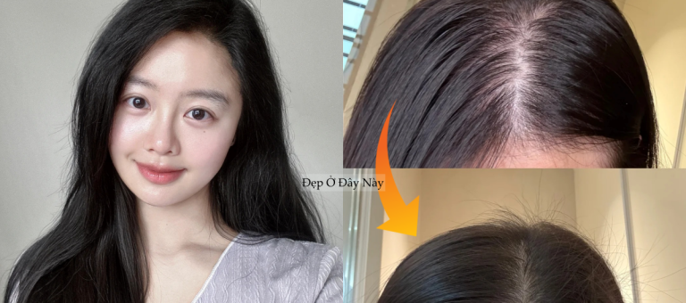 My hair was falling out so much that patches of scalp were visible, so I decided to follow these 5 hair care rules to get my thick, black hair back.